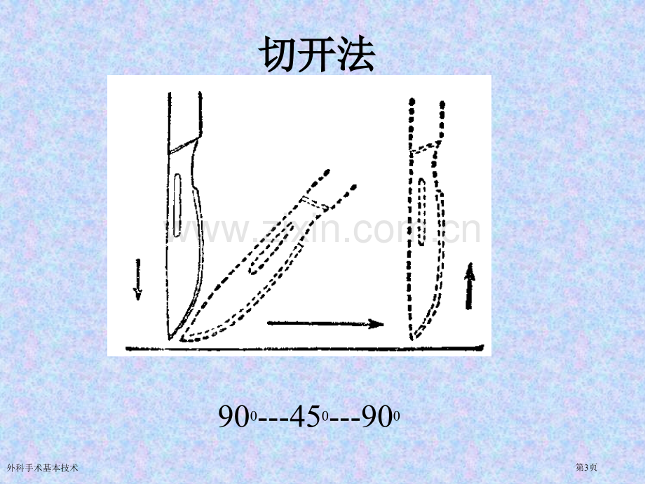 外科手术基本技术专家讲座.pptx_第3页