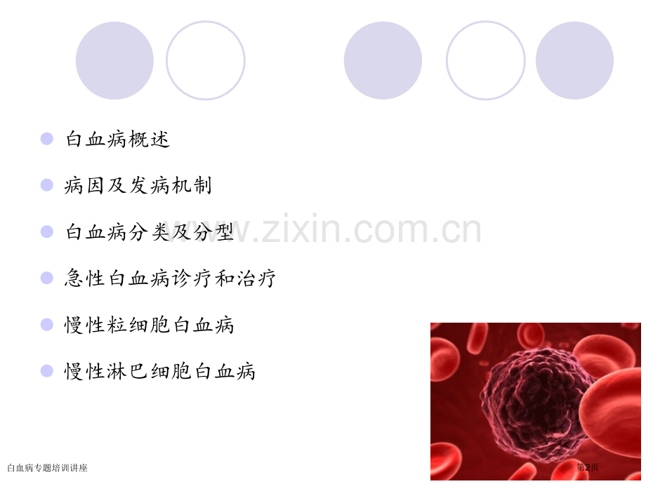 白血病专题培训讲座专家讲座.pptx_第2页