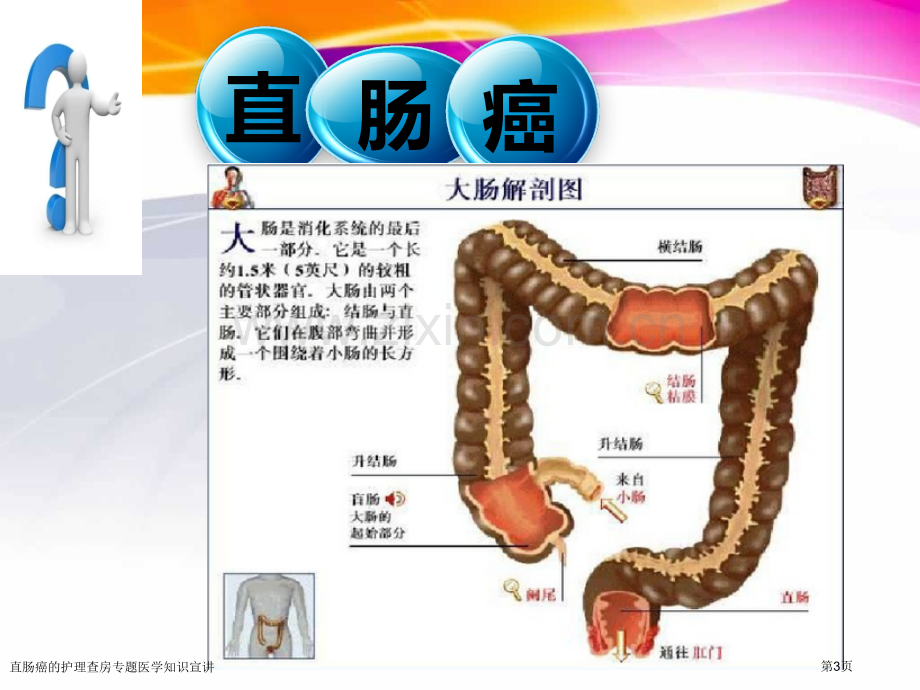 直肠癌的护理查房专题医学知识宣讲专家讲座.pptx_第3页