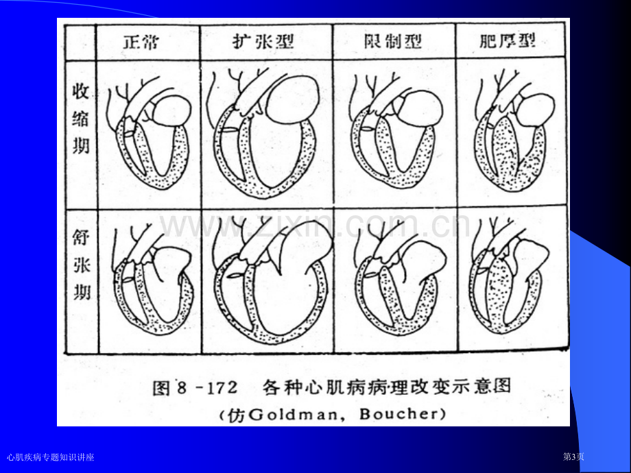 心肌疾病专题知识讲座专家讲座.pptx_第3页