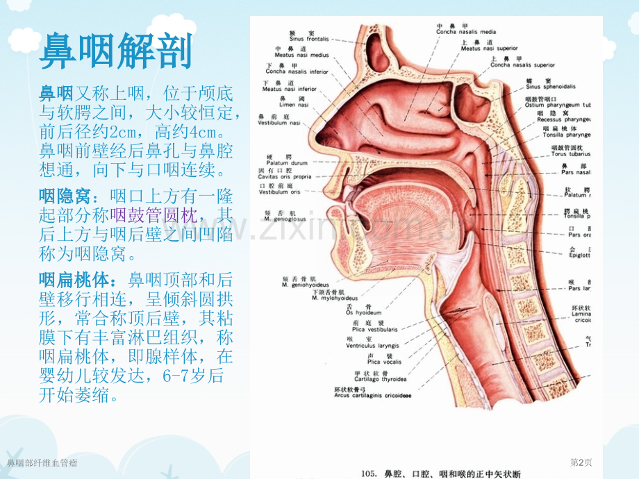 鼻咽部纤维血管瘤.pptx_第2页