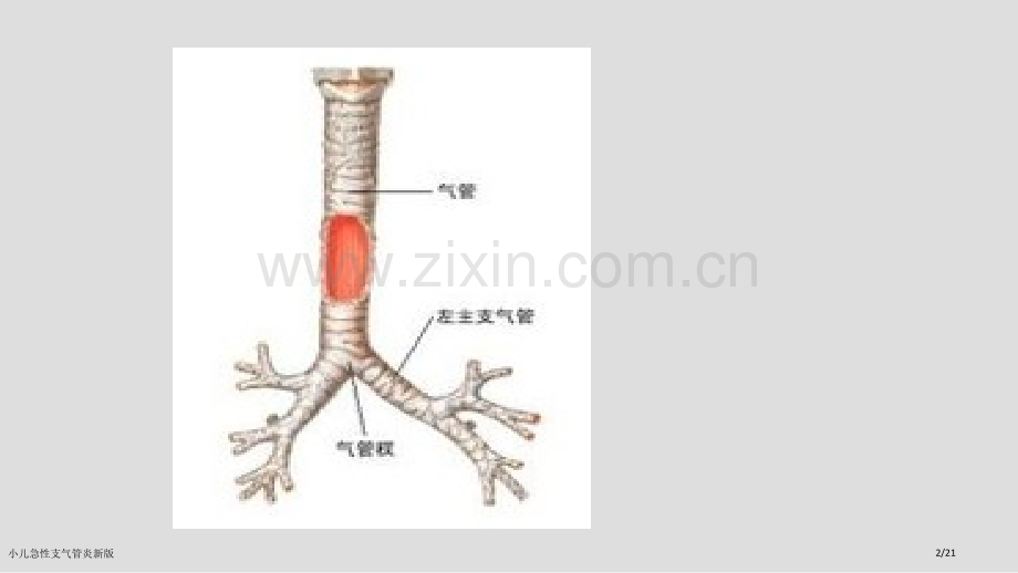 小儿急性支气管炎新版.pptx_第2页
