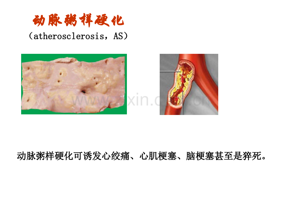 17王连生调脂与抗动脉粥样硬化药.pptx_第2页