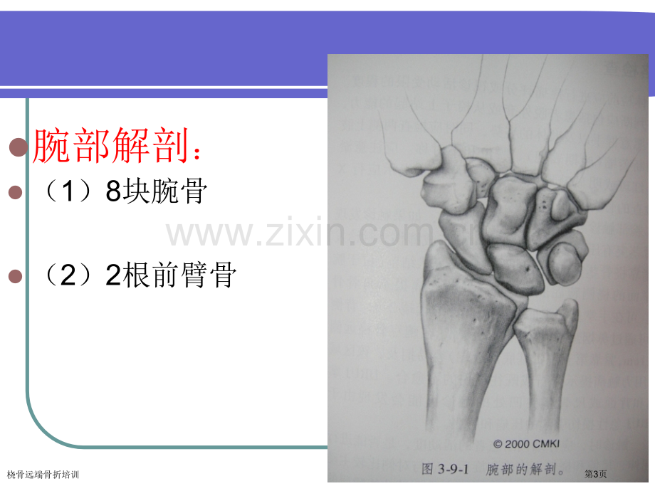 桡骨远端骨折培训专家讲座.pptx_第3页