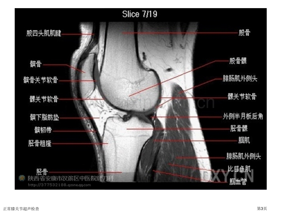 正常膝关节超声检查专家讲座.pptx_第3页