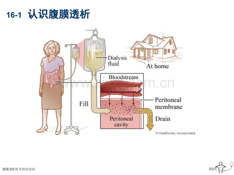 腹膜透析医学知识培训专家讲座.pptx_第2页