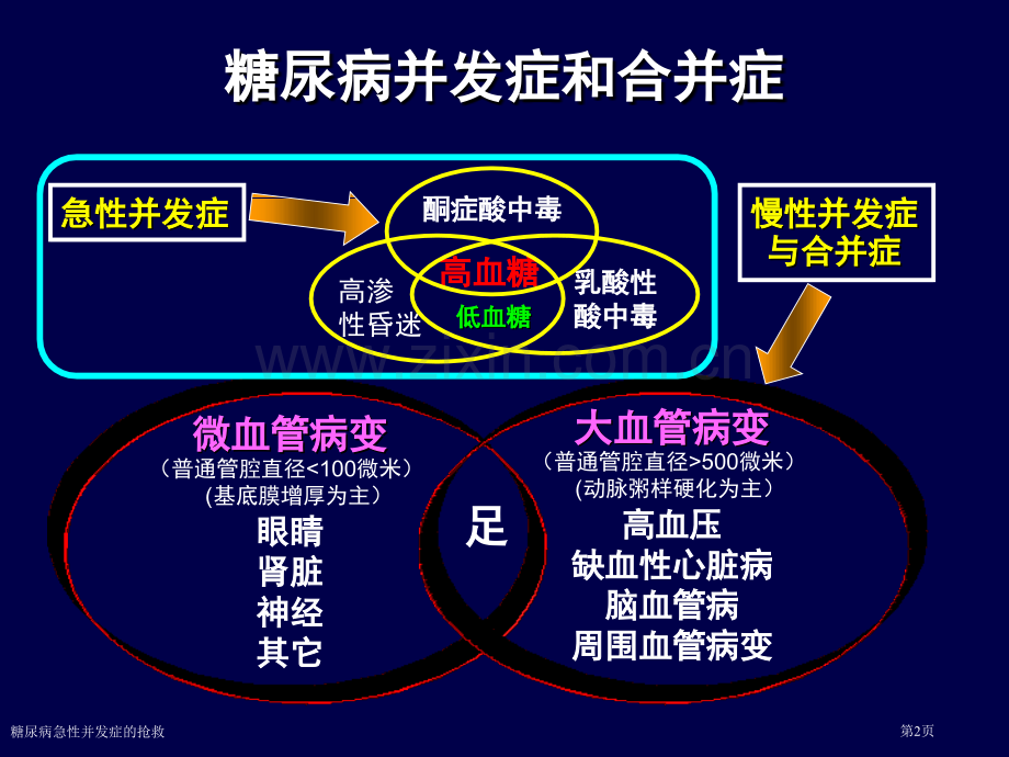 糖尿病急性并发症的抢救.pptx_第2页