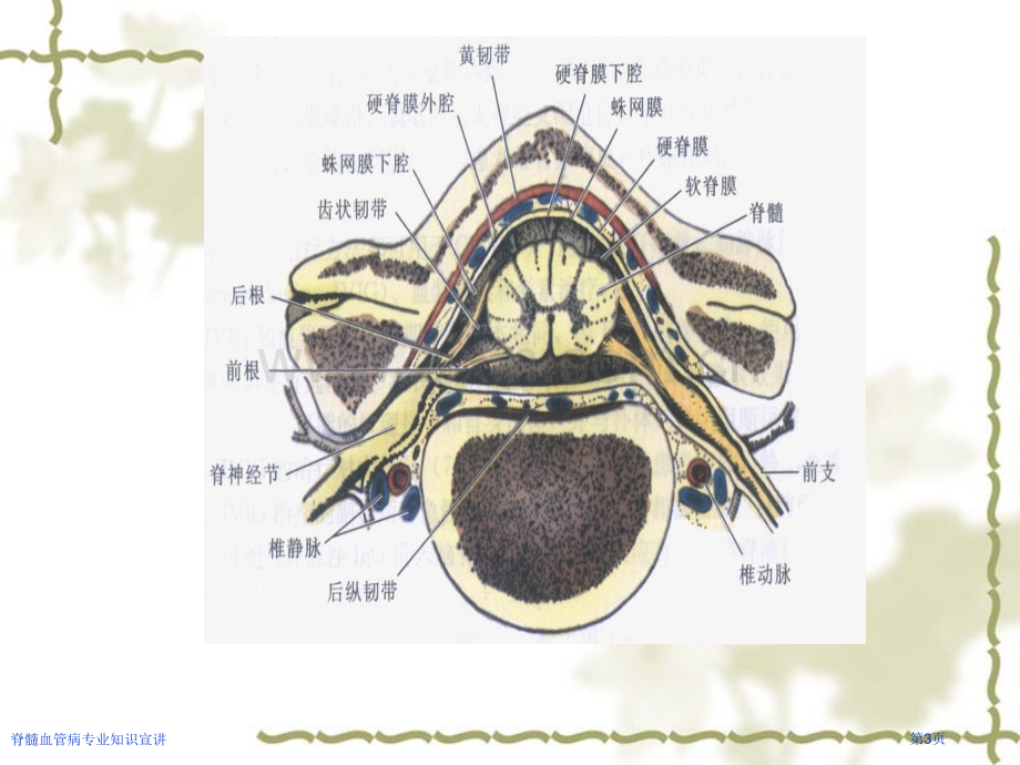 脊髓血管病专业知识宣讲.pptx_第3页