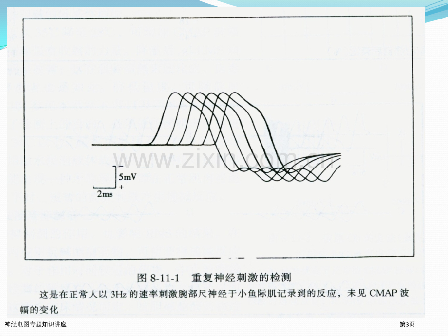 神经电图专题知识讲座.pptx_第3页