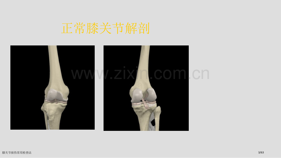 膝关节损伤常用检查法.pptx_第3页