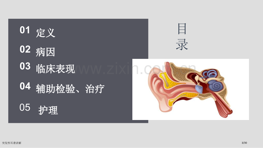 突发性耳聋讲解.pptx_第3页