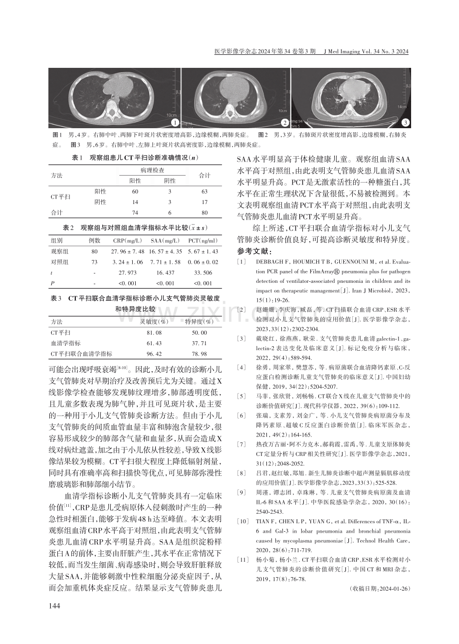 CT平扫联合血清学指标对小儿支气管肺炎的诊断价值.pdf_第2页