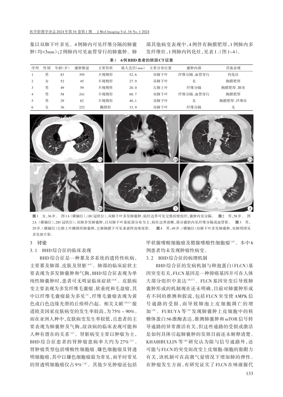 6例BHD综合征肺部CT特征分析.pdf_第2页