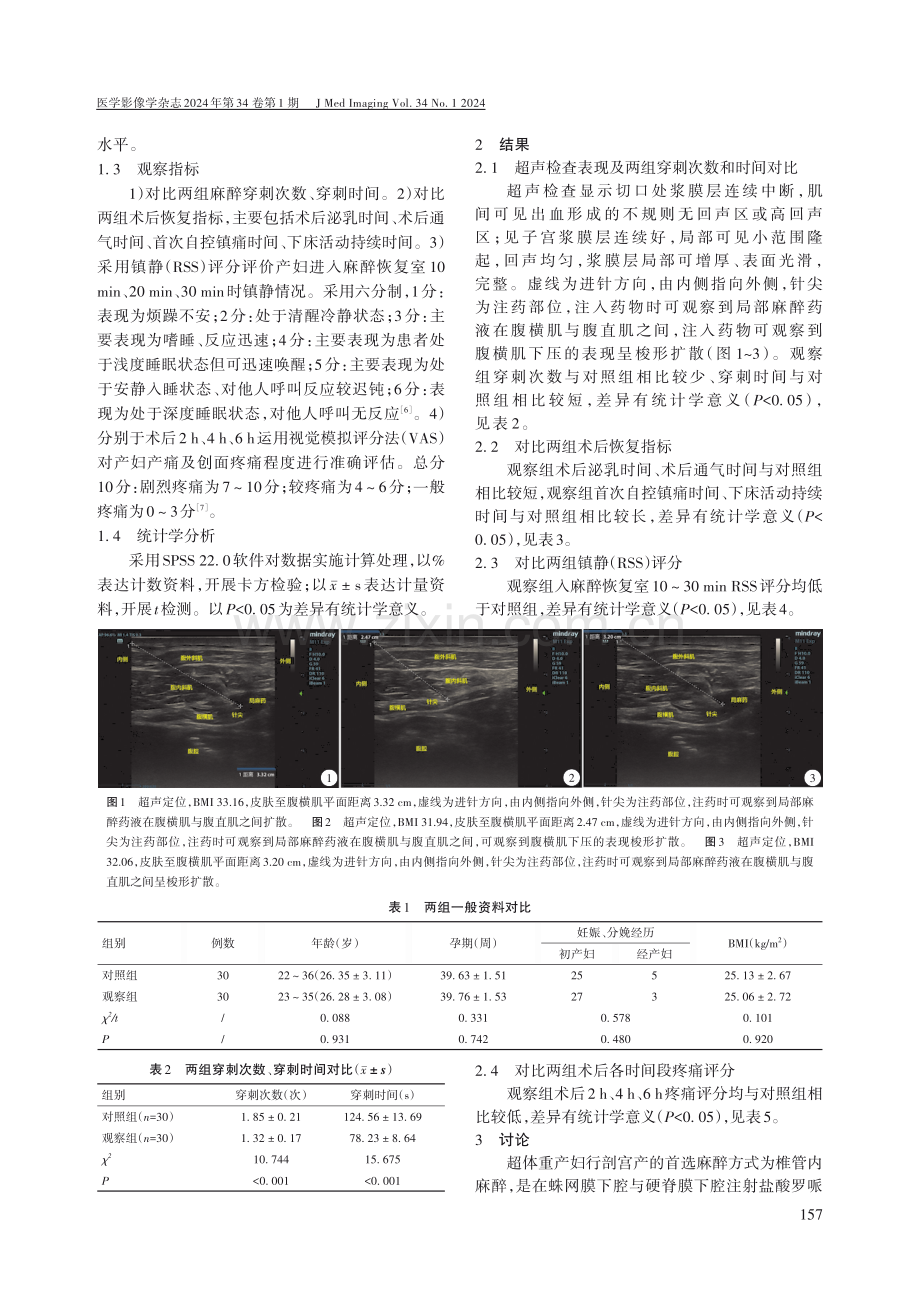 超声引导下椎管内麻醉联合腹横肌平面神经阻滞在超体重产妇剖宫产术中的应用价值.pdf_第2页