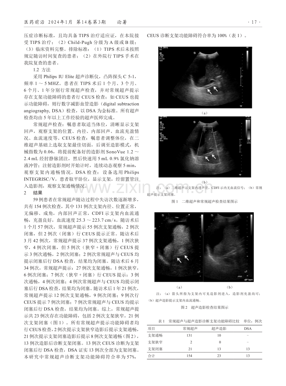 超声造影在肝硬化门静脉高压症行经颈静脉肝内门体分流术后效果监测中的应用.pdf_第2页