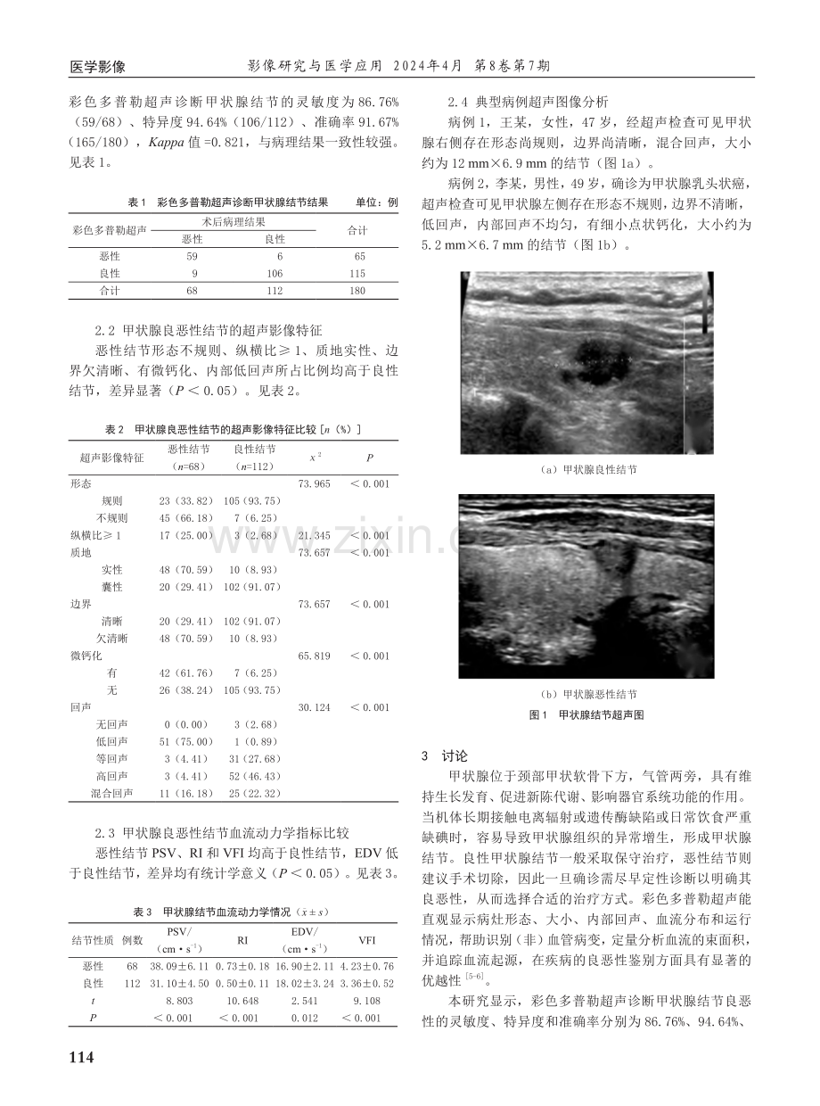 彩色多普勒超声在鉴别诊断甲状腺结节良恶性中的价值以及超声影像特征分析.pdf_第2页