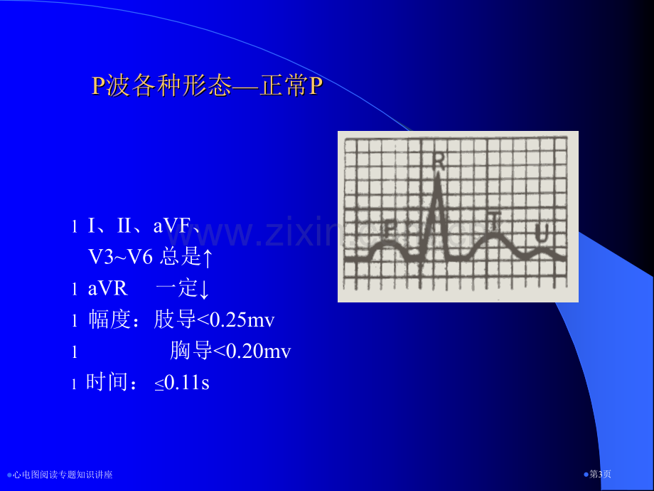 心电图阅读专题知识讲座专家讲座.pptx_第3页