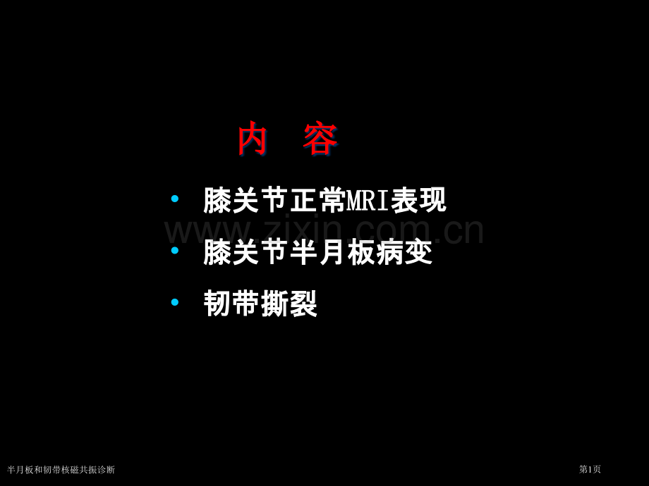 半月板和韧带核磁共振诊断专家讲座.pptx_第1页