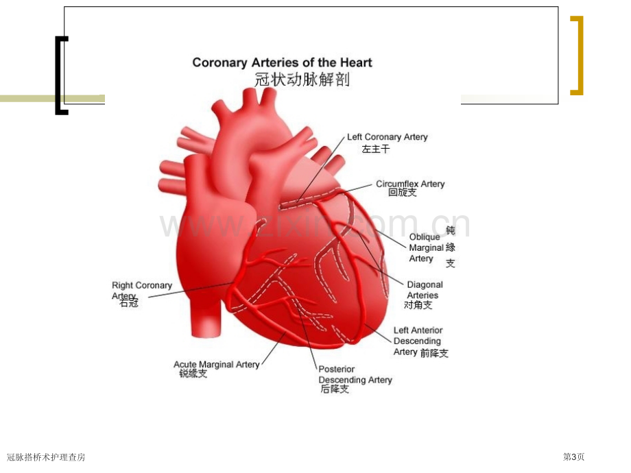 冠脉搭桥术护理查房.pptx_第3页