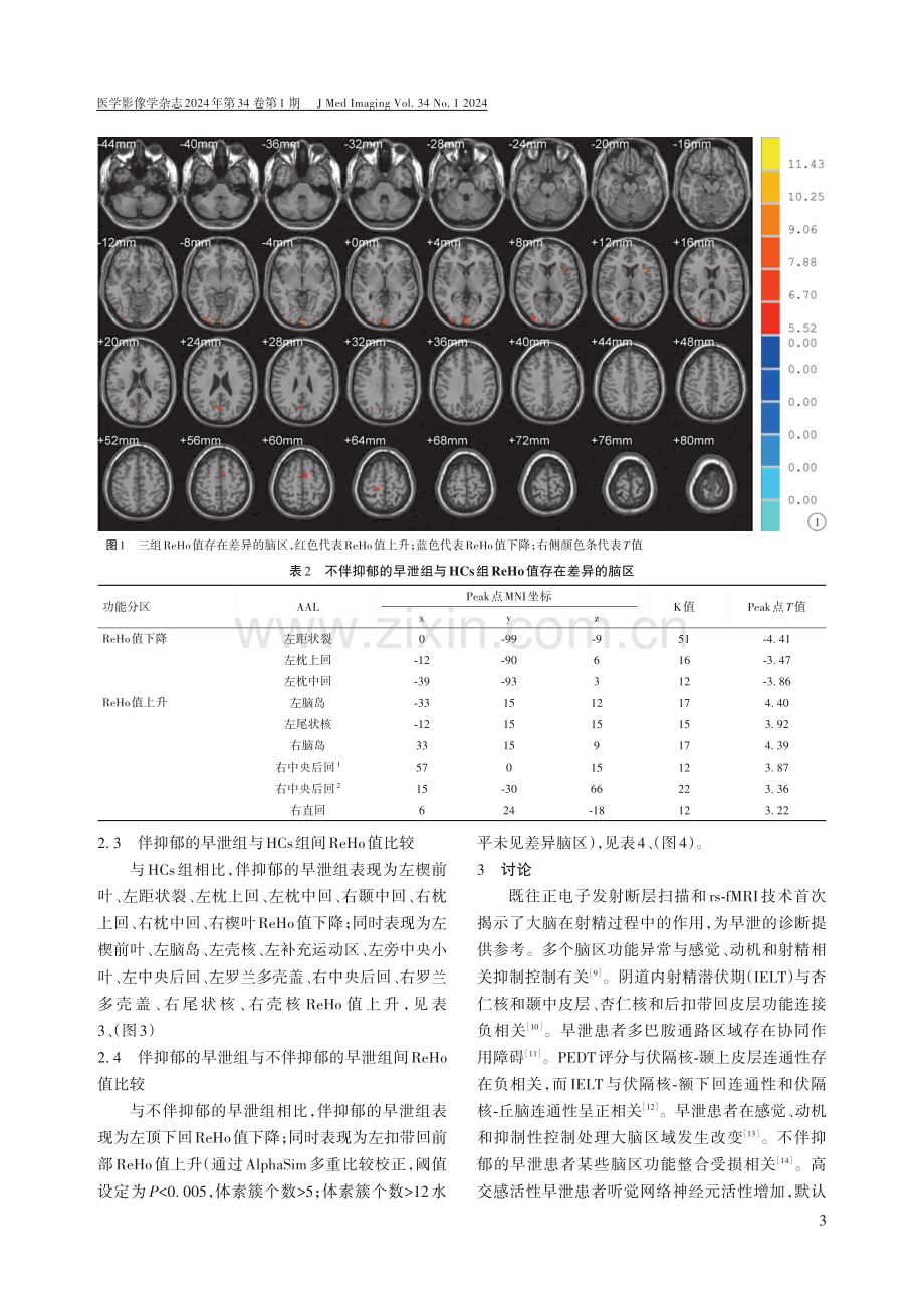 伴与不伴抑郁的早泄患者静息态脑功能特征差异分析.pdf_第3页