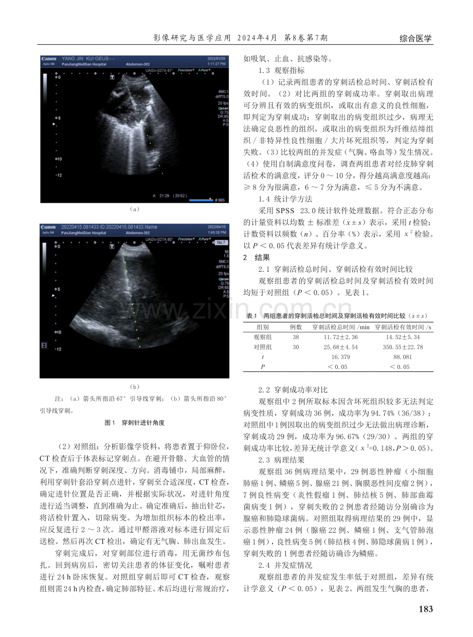 超声引导下经皮肺穿刺活检在肺外周型占位病变诊断中的应用研究.pdf_第2页