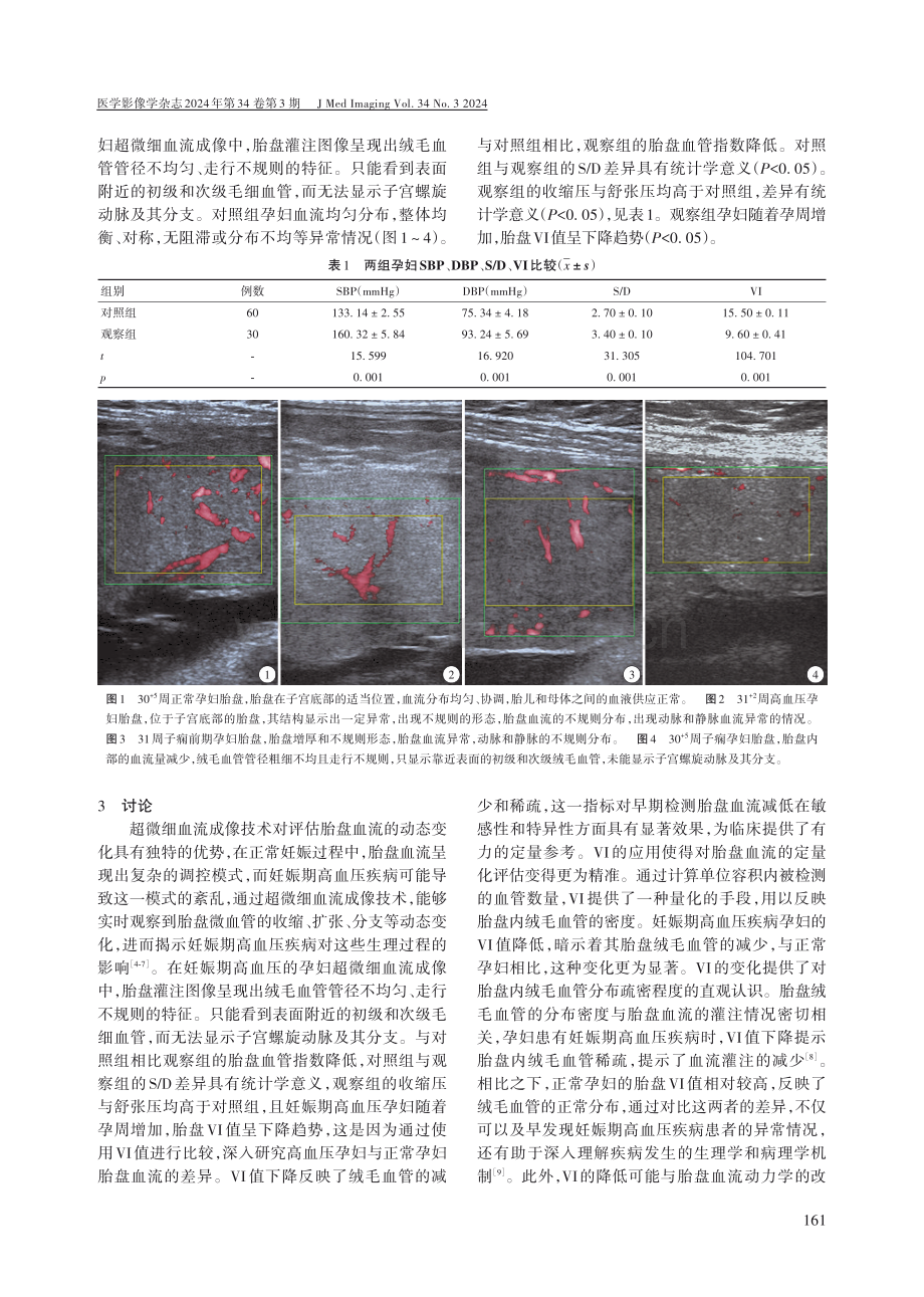 超微细血流成像技术评估妊娠期高血压疾病对胎盘血流灌注价值.pdf_第2页