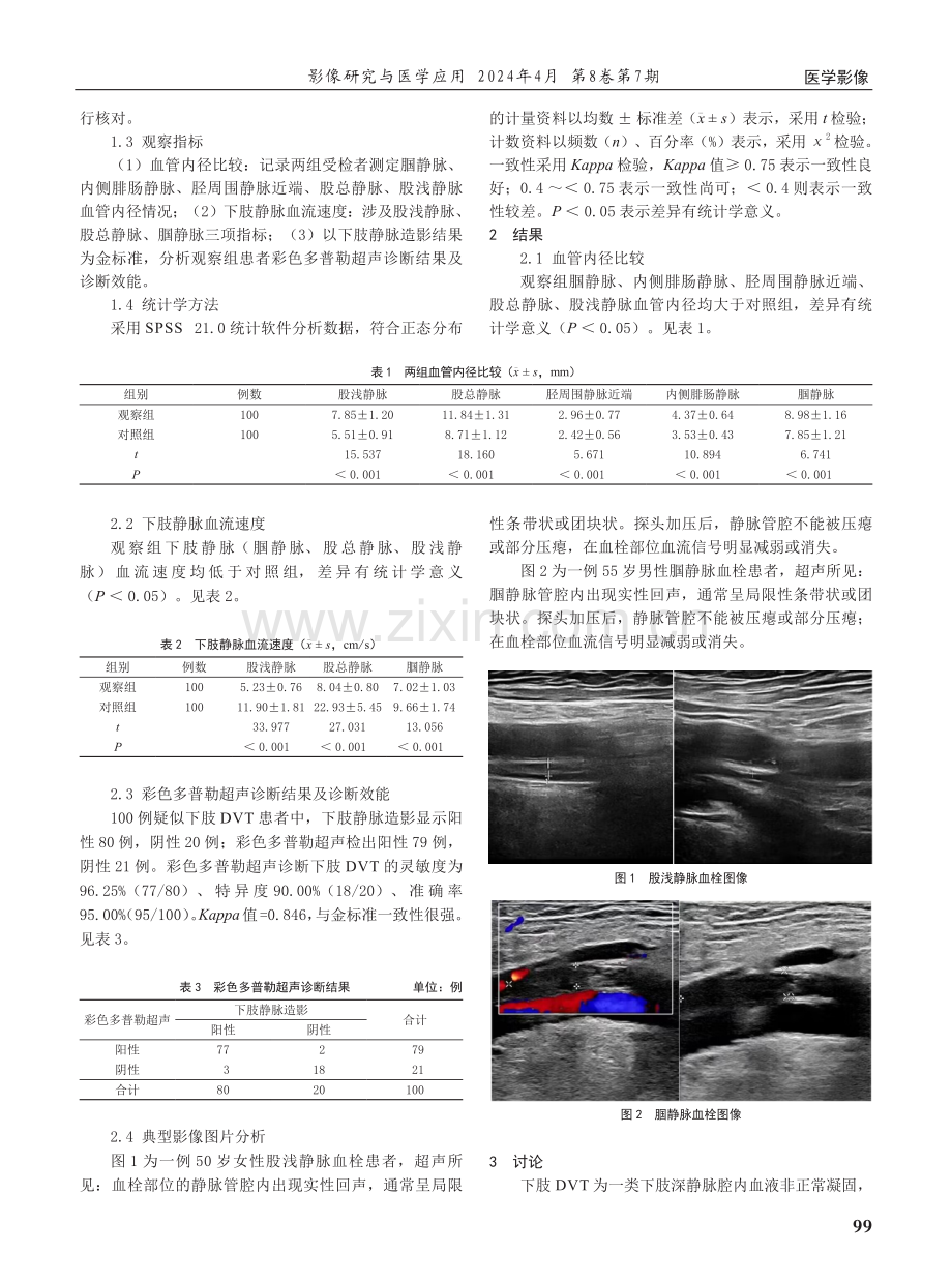 彩色多普勒超声诊断下肢深静脉血栓形成的临床价值分析.pdf_第2页