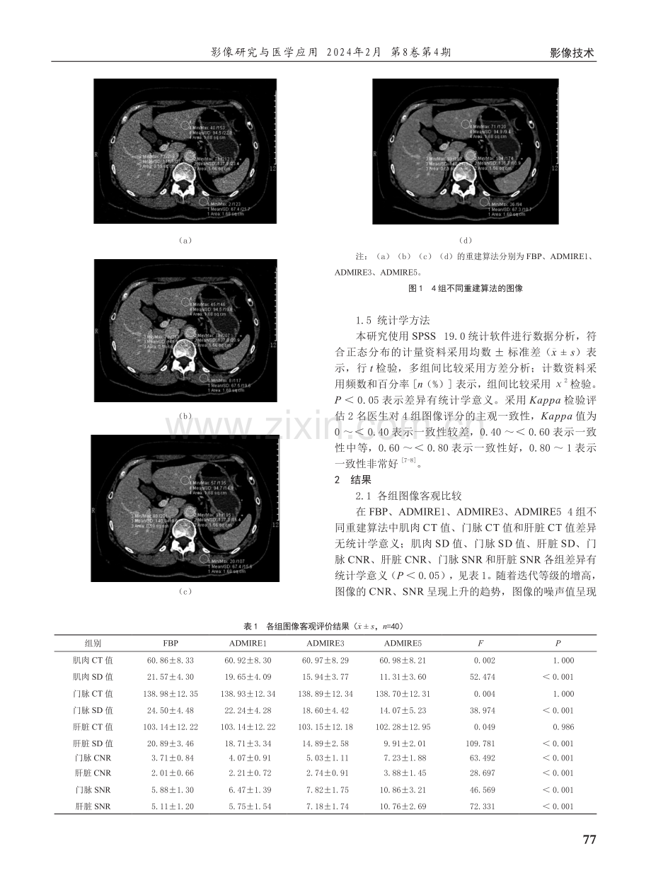 Force CT高级建模迭代重建算法对门静脉图像质量的影响.pdf_第2页