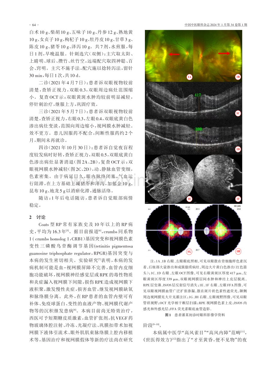 中西医结合治疗Coats型视网膜色素变性1例.pdf_第2页