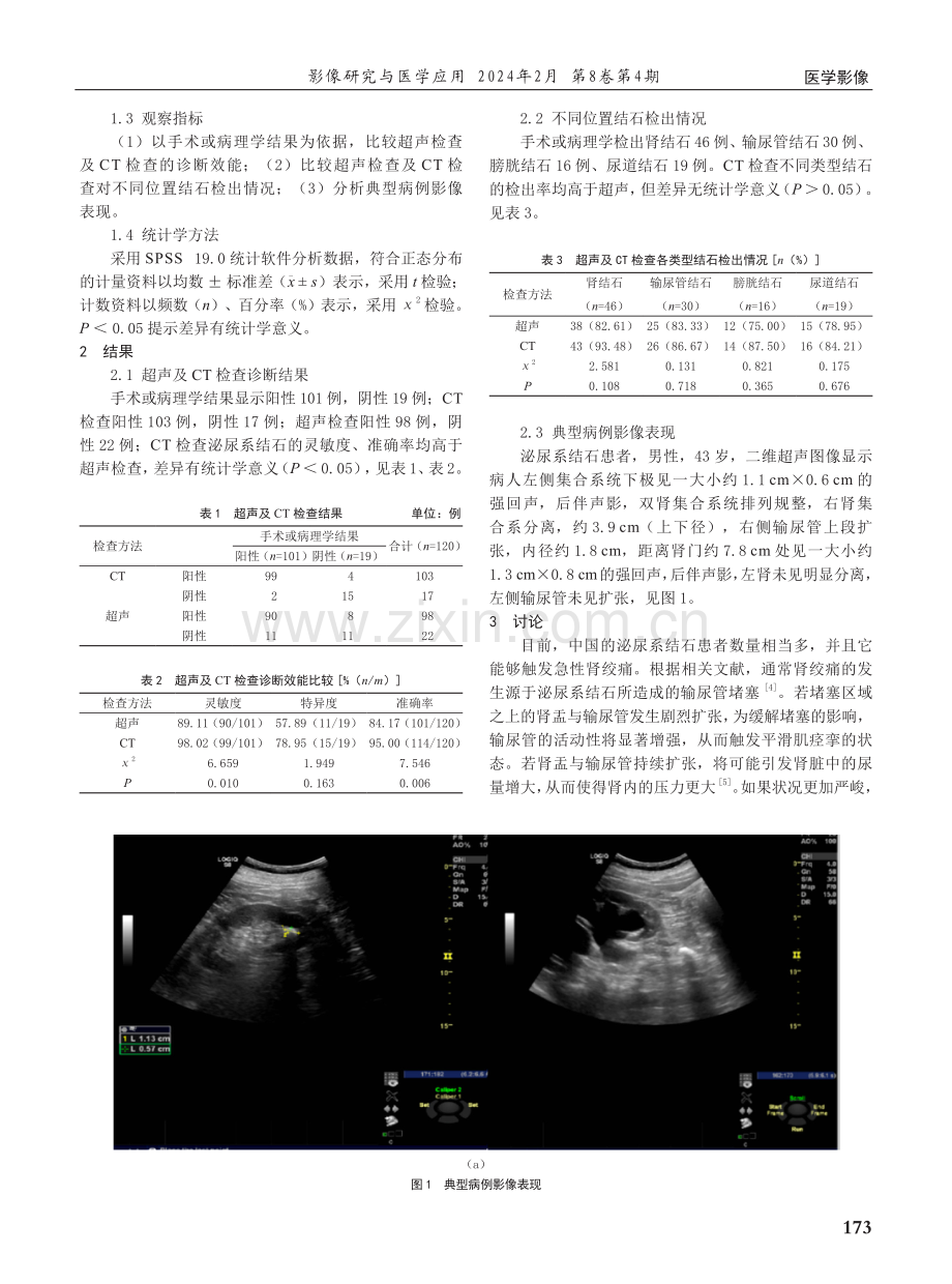 超声与CT检查诊断泌尿系结石的临床价值.pdf_第2页