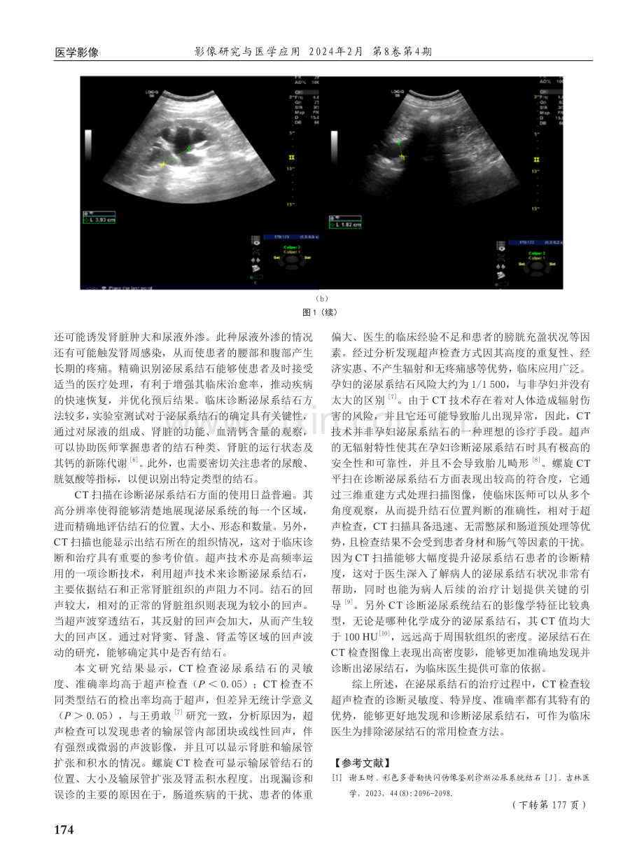 超声与CT检查诊断泌尿系结石的临床价值.pdf_第3页
