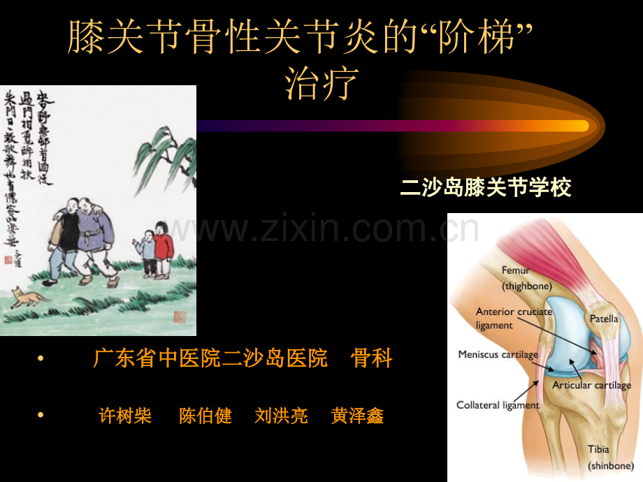 膝关节骨关节的阶梯治疗.pptx_第1页