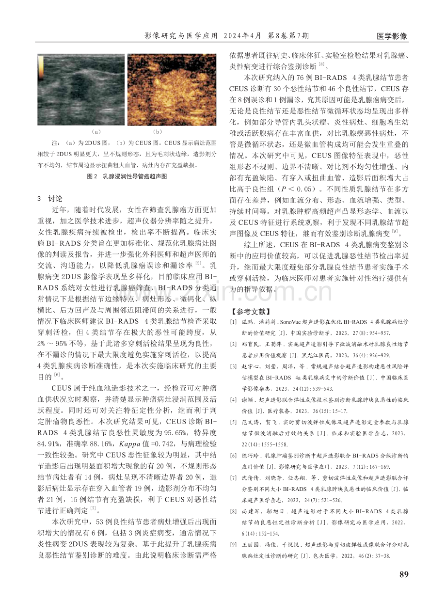 超声造影在BI-RADS 4类乳腺疾病诊断中的临床价值研究.pdf_第3页