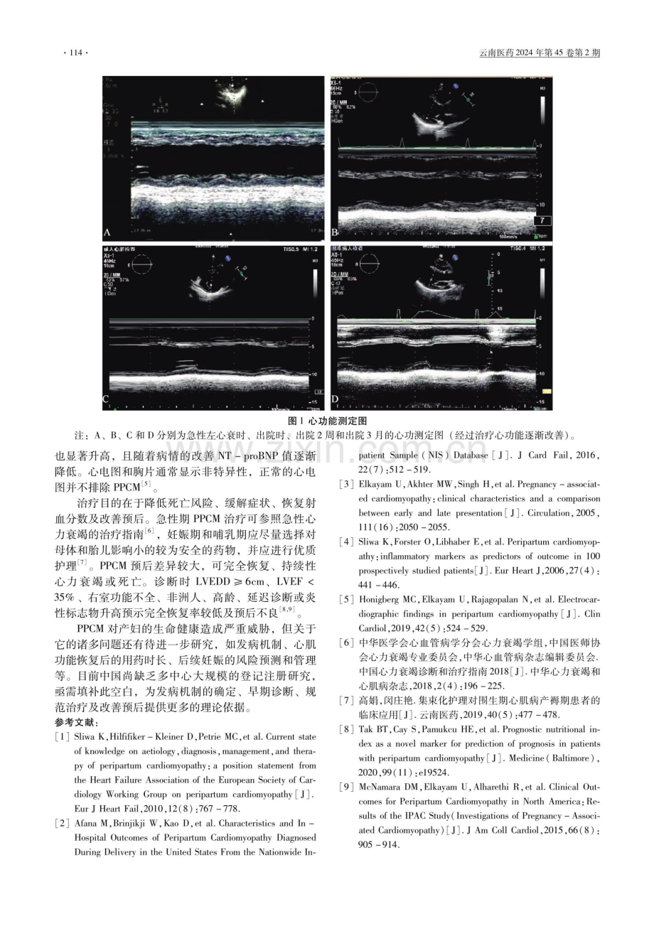 初产妇伴围产期心肌病1例报道.pdf_第2页