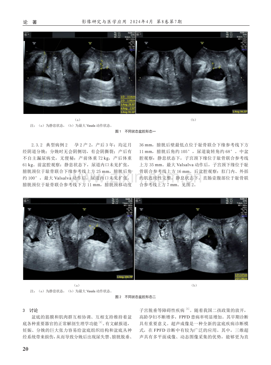 彩色多普勒超声仪在诊断女性盆底障碍性疾病中的价值研究.pdf_第3页