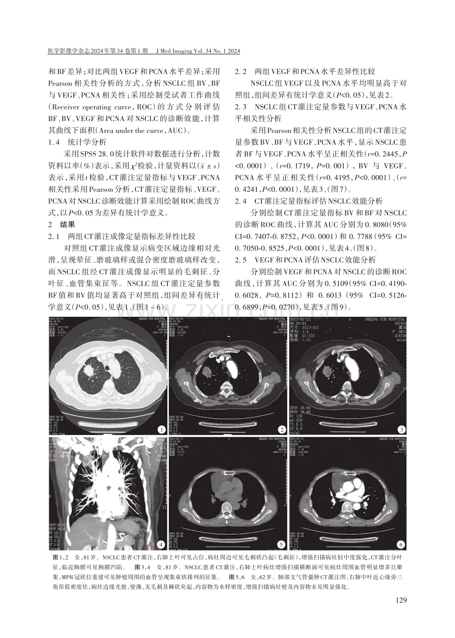 CT灌注成像定量参数与非小细胞肺癌患者VEGF、PCNA因子水平相关性分析.pdf_第2页