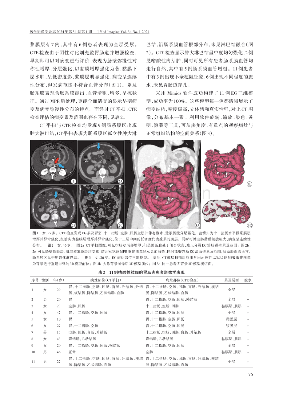 CT小肠造影联合虚拟3D打印对EG累及肠壁程度的应用价值.pdf_第3页