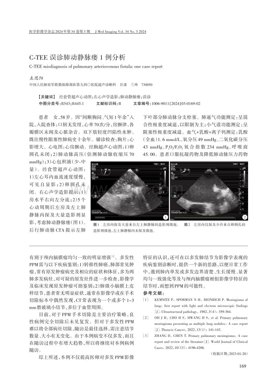 C-TEE误诊肺动静脉瘘1例分析.pdf_第1页