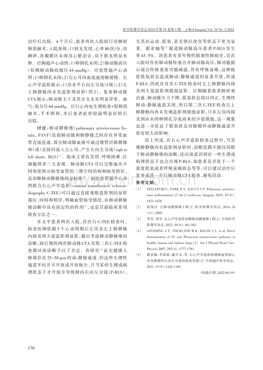 C-TEE误诊肺动静脉瘘1例分析.pdf_第2页