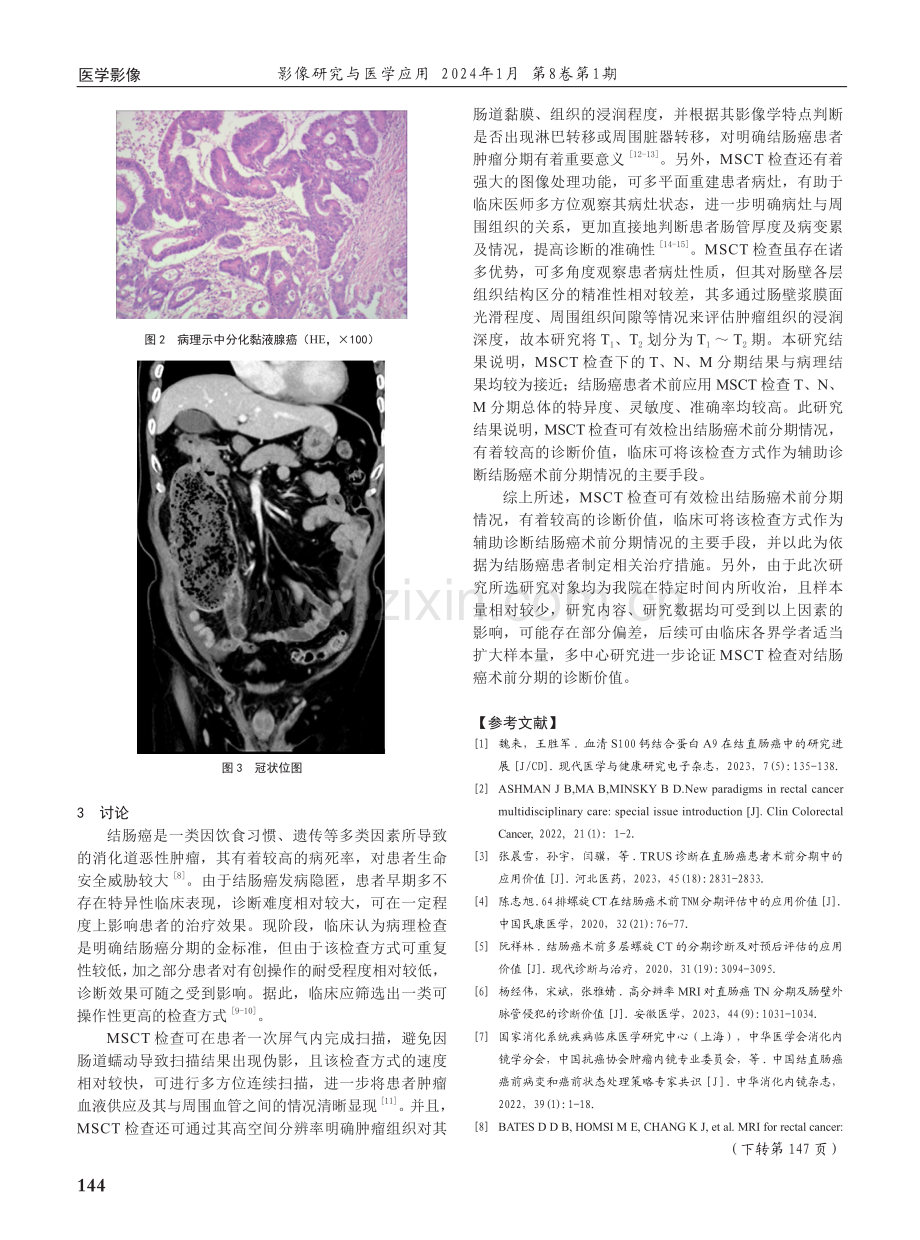 MSCT检查应用于结肠癌术前TNM分期诊断的影像学特点及效能分析.pdf_第3页