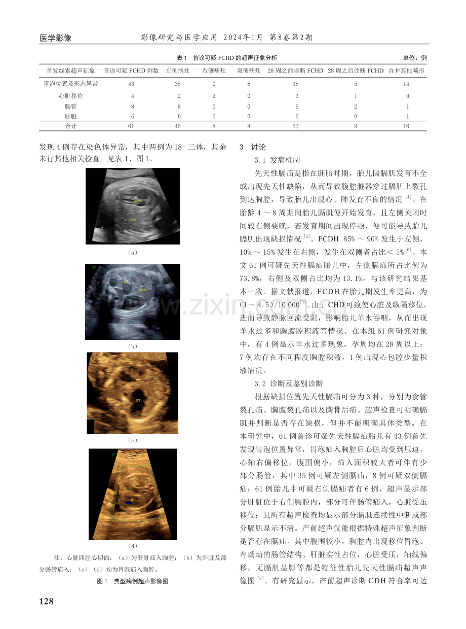 产前超声诊断胎儿膈疝病例分析.pdf_第2页