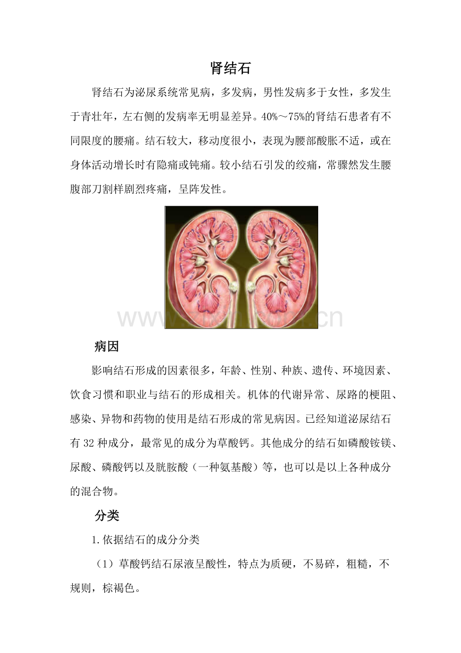 结石病治疗方案和日常预防.doc_第1页