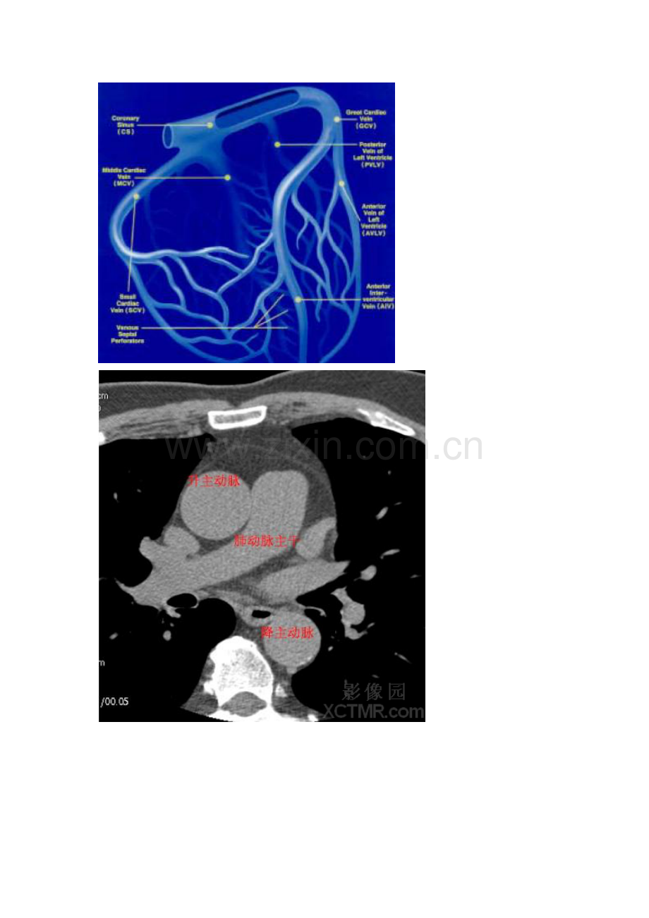 心脏冠状动脉CT解剖中文详细标注(图文)CardiacAnatomy.doc_第3页