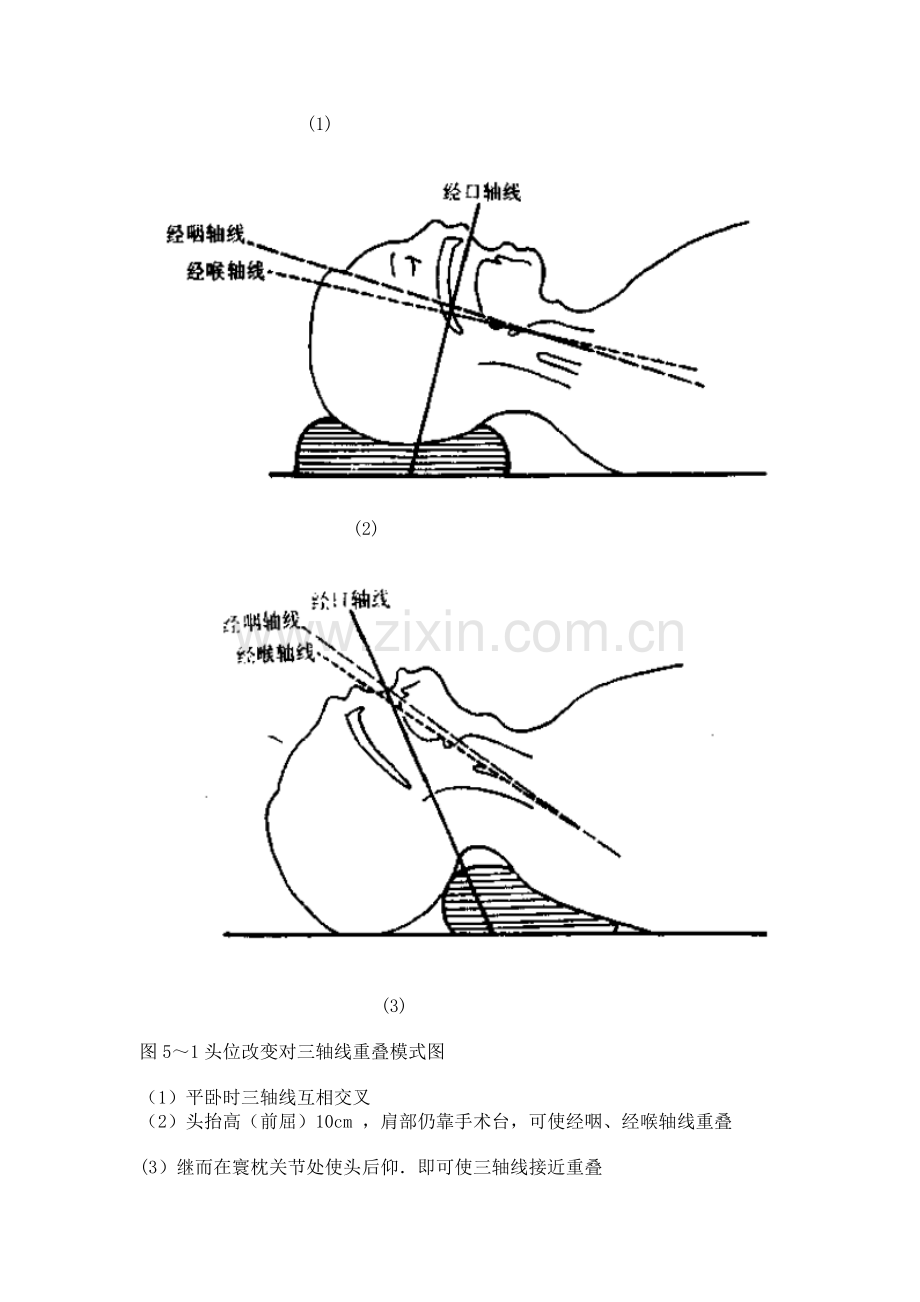 第五章气管及支气管内插管.doc_第2页