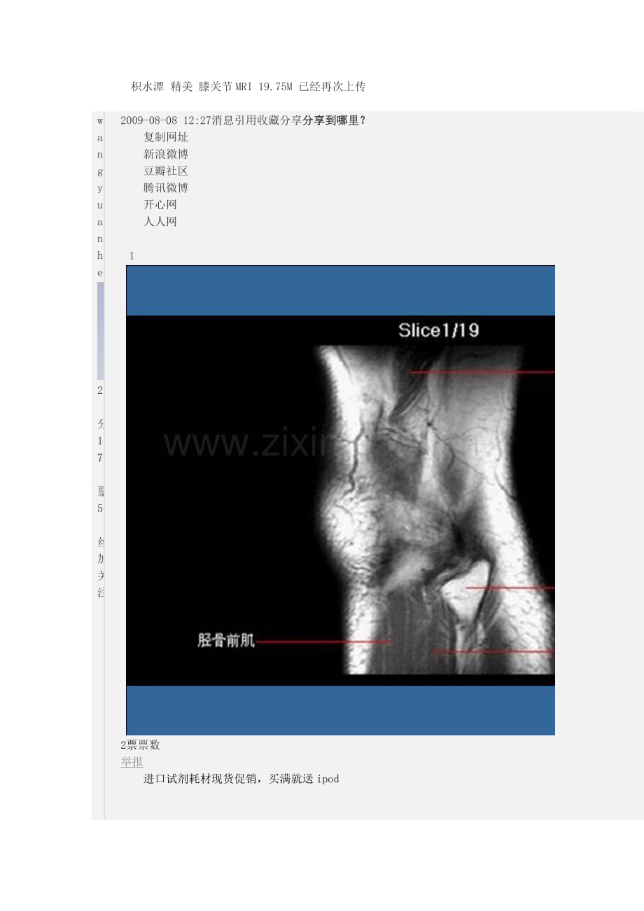 膝关节MRI解剖图.doc_第2页