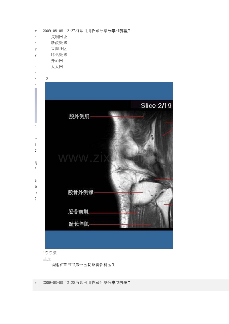 膝关节MRI解剖图.doc_第3页