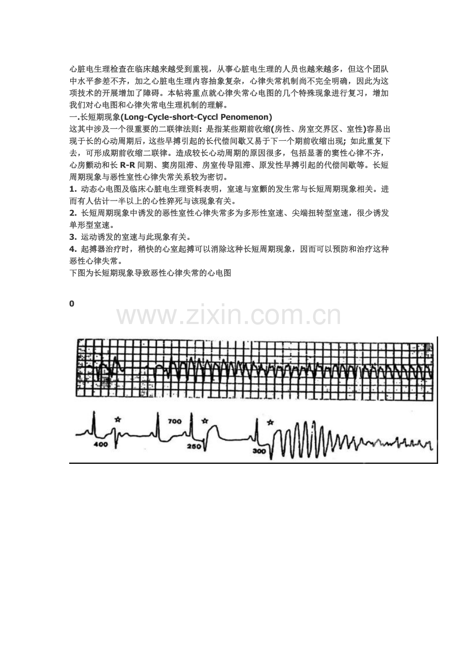 心脏电生理介入扫盲贴-----心律失常心电图的几个特殊现象.doc_第1页