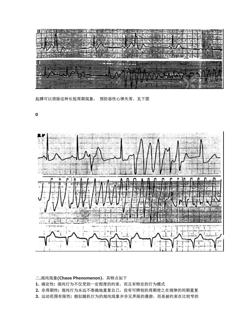 心脏电生理介入扫盲贴-----心律失常心电图的几个特殊现象.doc_第2页