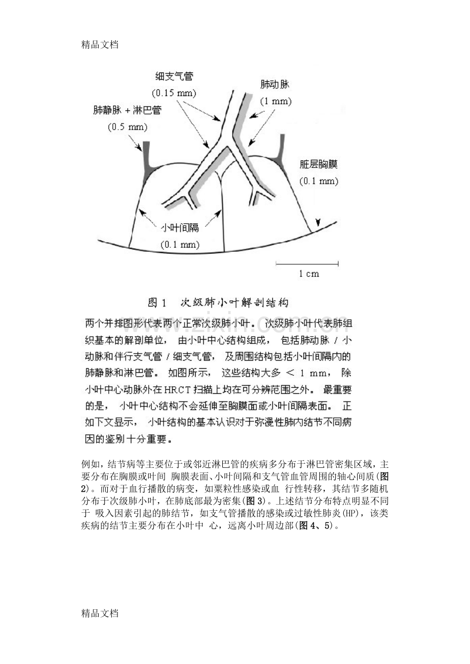 肺内多发结节的HRCT诊断及鉴别诊断流程教案资料.doc_第3页