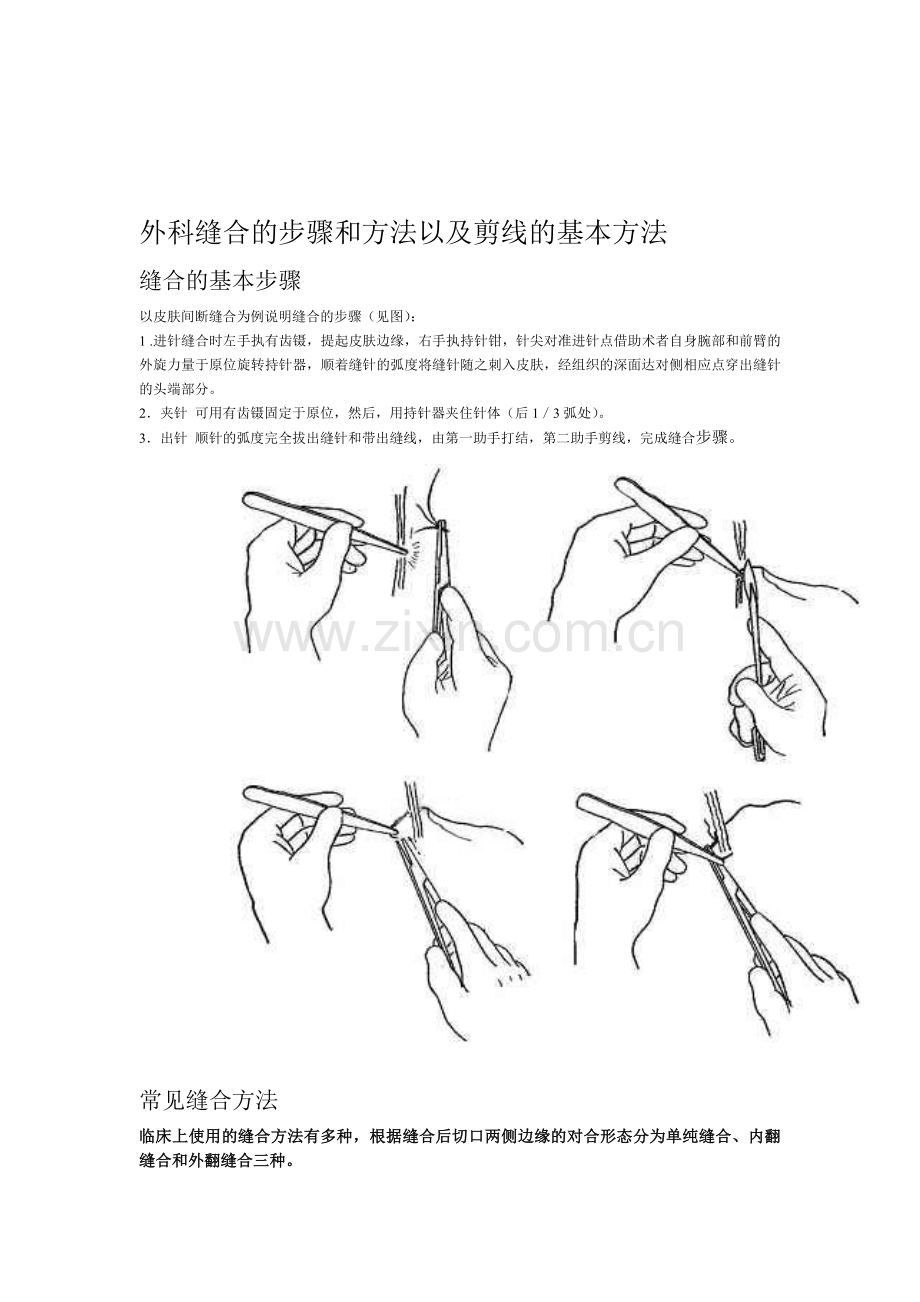 外科缝合的步骤和方法以及剪线的基本方法资料.doc_第1页